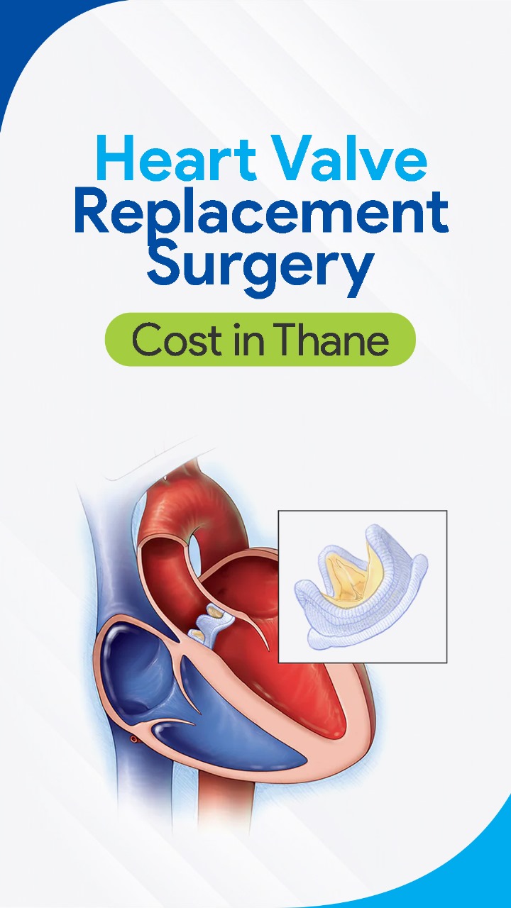 Heart Valve Replacement Cost Thane
