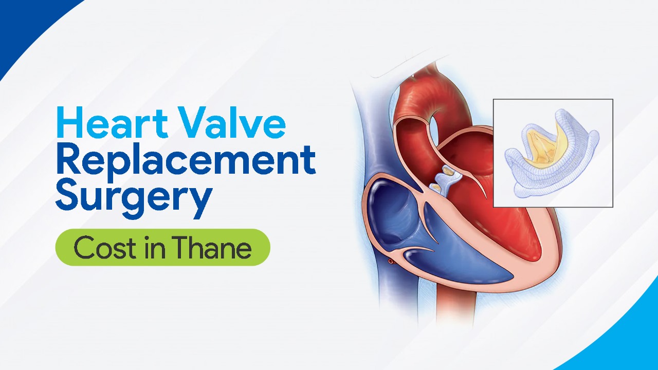 Heart Valve Replacement Cost in Thane