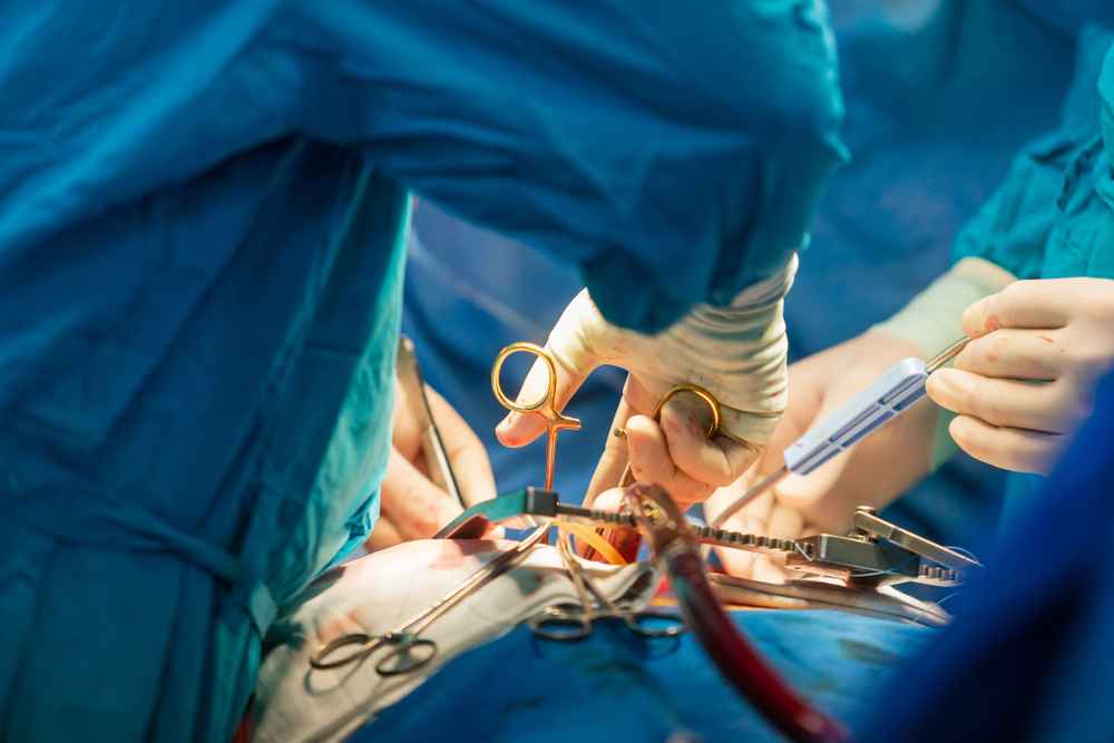 Cardiac Surgery Department Jinkushal